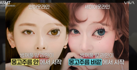 세미아웃라인 쌍수 장원영 쌍꺼풀 분석해 보기 관련 이미지 5