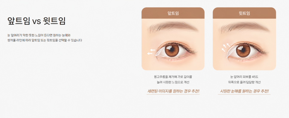 If You’re Concerned About a Tight-Looking Eye Shape | When Medial Epicanthoplasty & Upper Epicanthoplasty Are Needed and How They Differ at 바바성형외과 image 2