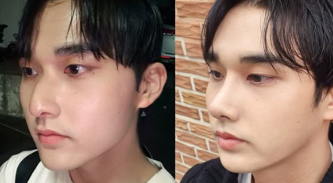 2025년 코성형 트렌드: 자연스러움이 대세 관련 이미지 3