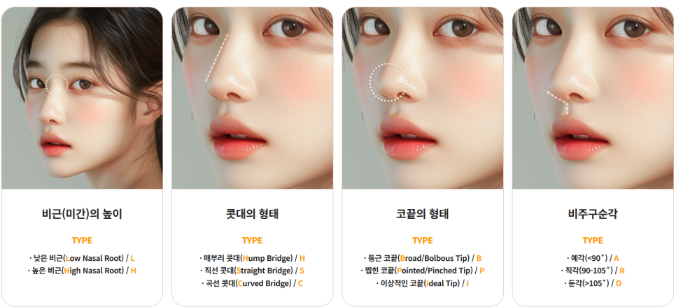 코성형 재수술, 처음보다 더 어려운 이유는? 성공하려면 이것부터! 관련 이미지 8