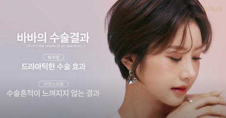 바바성형외과의 코 성형 3가지 상담 원칙과 수술 철학 관련 이미지 10