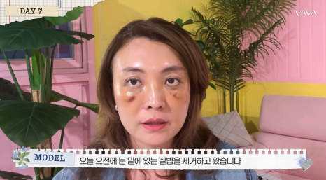 50대에도 자신감 가득 엄마의 두번째 리즈시절, 중년 눈성형&middot;하안검&middot;이마거상 리얼 후기 관련 이미지 9