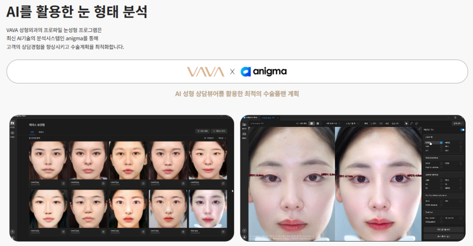 인아웃라인 vs 세미아웃라인 쌍꺼풀 라인 선택 전 꼭 알아야 할 기준 (인상 차이 나는 이유) 관련 이미지 7