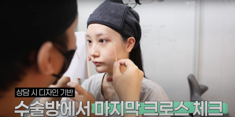 바바성형외과 절개 쌍수 절개 눈매교정 쌍꺼풀  재수술  사례 관련 이미지 15