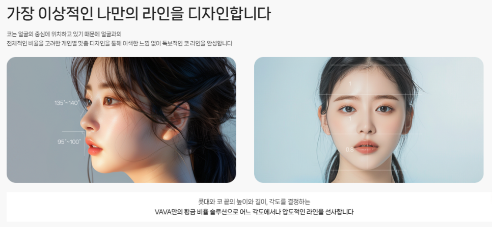 복코, 매부리코, 낮은코 | 바바성형외과 유형별 코성형, 내 코에 맞는 방향 찾기 관련 이미지 25