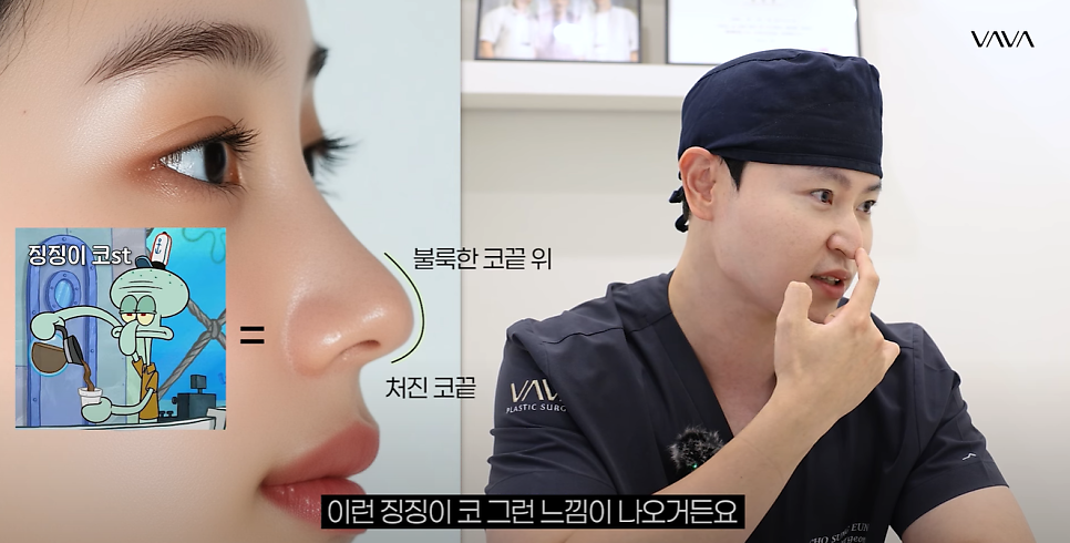 요즘 코성형 트렌드 & 코끝 재수술 알아보기 관련 이미지 3