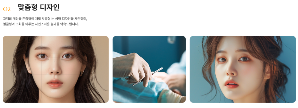 졸려보이는 눈 자연유착 밑트임 위트임으로 또렷하게 (리얼 후기) 관련 이미지 17