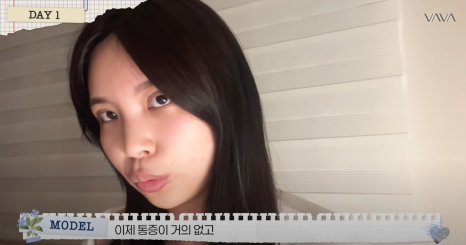 쌍수 재수술 성공기 ｜ 졸려보이는 눈 세미아웃으로 예뻐진 리얼 Before & After 관련 이미지 10