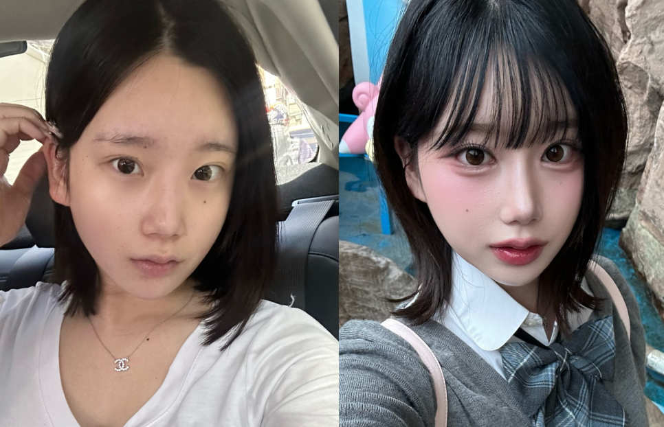 바바성형외과 눈&middot;코 성형 한 달 차 리얼 케이스 (윈터, 카리나 코) 관련 이미지 1