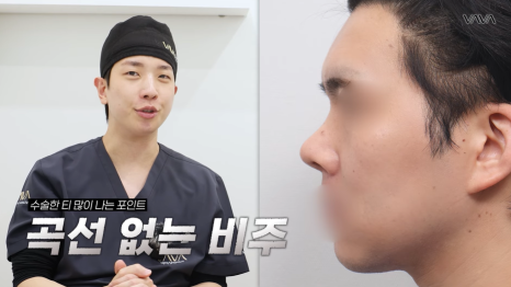 첫 코 성형, 언제&middot;어떻게 해야 할지 기준 정리해드립니다 관련 이미지 32