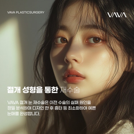 절개 눈성형 방법과 절개가 필요한 눈 유형 관련 이미지 5