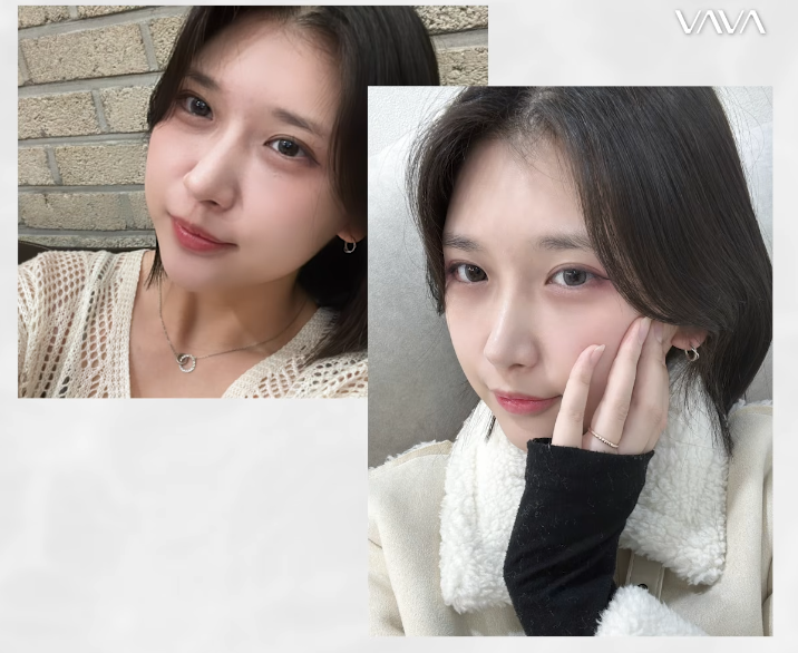 눈이랑 코 같이 하면 더 예뻐질까? ㅣ  동시성형 솔직 정리 관련 이미지 8