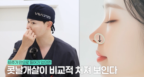2026년 코성형 트렌드 예측콧대에서 코끝, 그리고 콧구멍까지 보는 시대 관련 이미지 7
