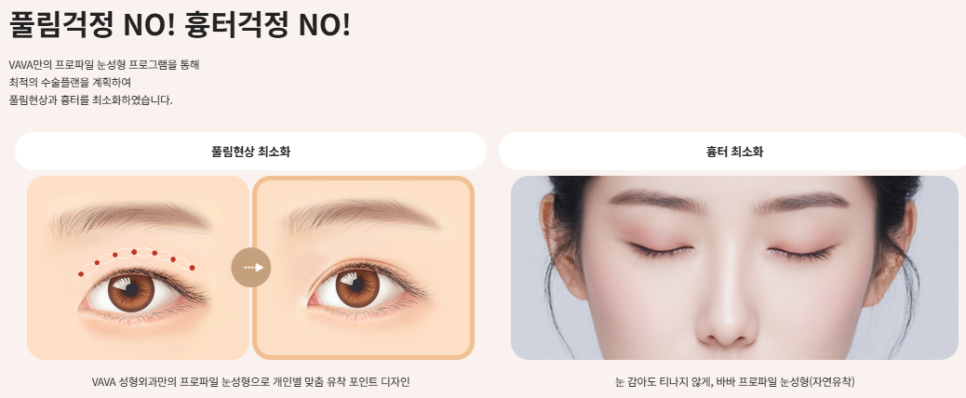 또렷하면서도 자연스러운 눈매를 완성하는 기준, 쌍꺼풀 수술의 방향성 관련 이미지 5