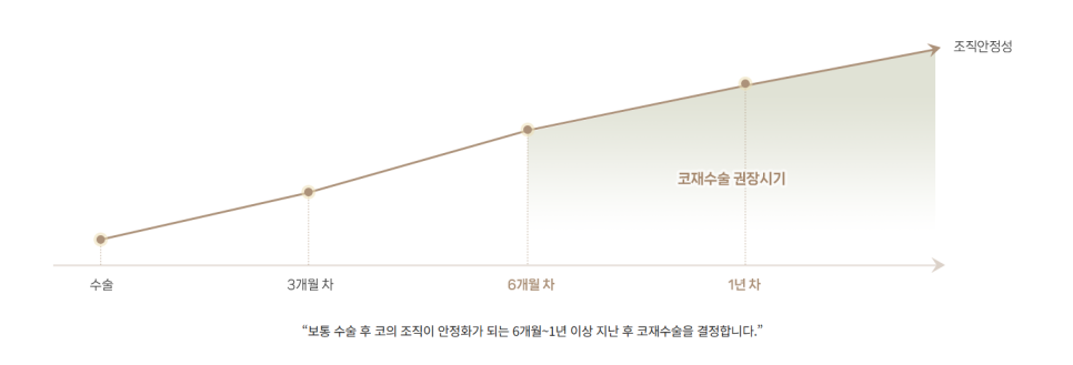 코성형 재수술, 처음보다 더 어려운 이유는? 성공하려면 이것부터! 관련 이미지 2