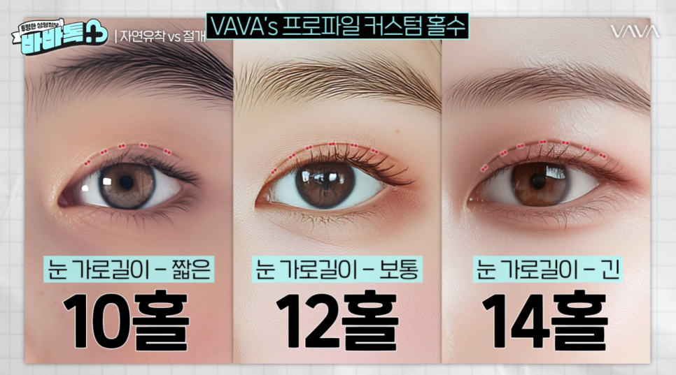 나에게 맞는 쌍꺼풀 수술법 총정리 : 절개, 부분절개, 매몰법까지 관련 이미지 5