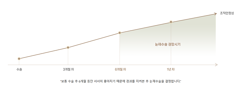 눈 재수술로 보다 완벽한 눈매라인 되찾기 관련 이미지 6