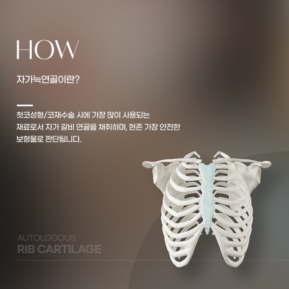 자가늑연골 코수술 우수성이 입증되다 관련 이미지 2