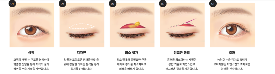 과하지 않게 또렷한 눈매, 세미아웃라인&middot;인아웃라인 쌍꺼풀 인기 이유 관련 이미지 8