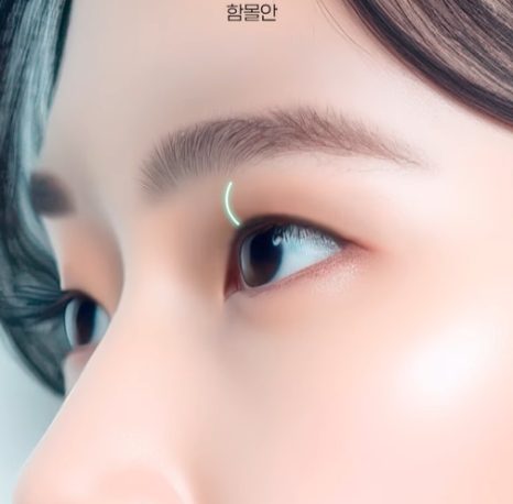 자연유착 VS 절개  어떤 기준으로 선택해야 할까? 관련 이미지 18