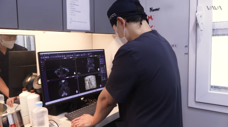 코재수술로 인상까지 달라질 수 있을까?｜바바성형외과 직반라인 코재수술 후기 관련 이미지 5