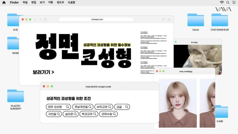 예쁜 코의 공통점은? 성형외과 원장이 알려주는 코 성형 성공하는 방법(리얼 후기 케이스) 관련 이미지 2