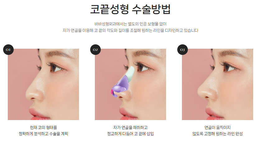 The Secret to a Refined Nose Line Lies in the Tip | BABA Plastic Surgery Tip Plasty image 8
