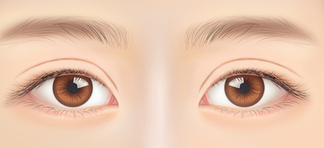 쌍꺼풀 재수술, 흉터 없이 가능할까? 관련 이미지 5