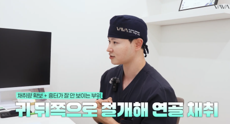 압구정 바바성형외과 | 코성형의 핵심, 비주의 중요성과 교정 방법 관련 이미지 16