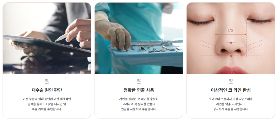 코성형 재수술, 처음보다 더 어려운 이유는? 성공하려면 이것부터! 관련 이미지 3