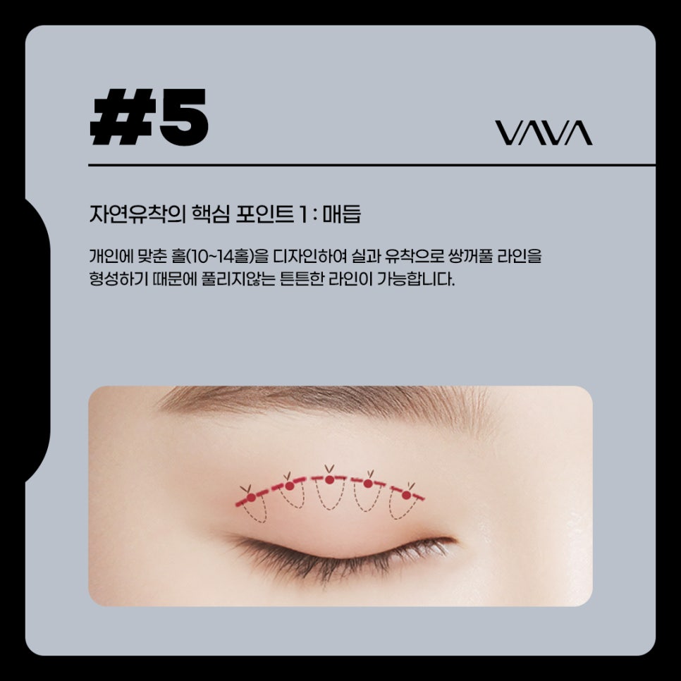 자연유착 쌍꺼풀 내게 어울리는 비율로 관련 이미지 5