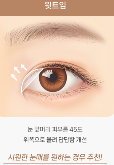 졸려 보이는 눈 안검하수 절개 쌍수 전후 차이 관련 이미지 8