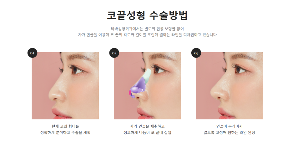 코끝 처짐 없이 자연스러운 맞춤 라인으로 관련 이미지 7