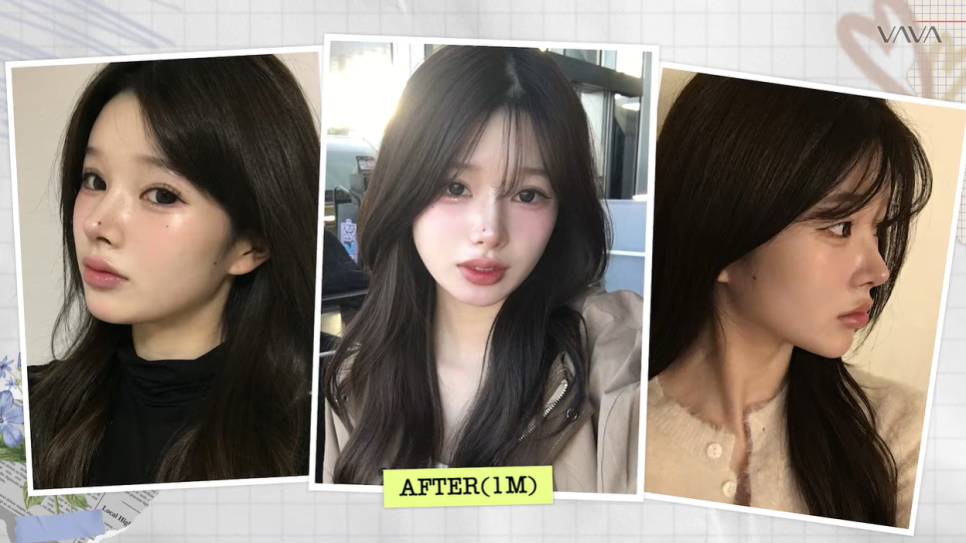 압구정 바바성형외과 자가늑 코성형 후기｜복코&middot;매부리코 교정 한달차 변화 관련 이미지 24