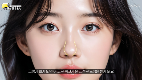 내 얼굴형에 맞는 코, 따로 있습니다 &mdash; 코성형 전 체크해야 하는 5가지 비율 관련 이미지 6