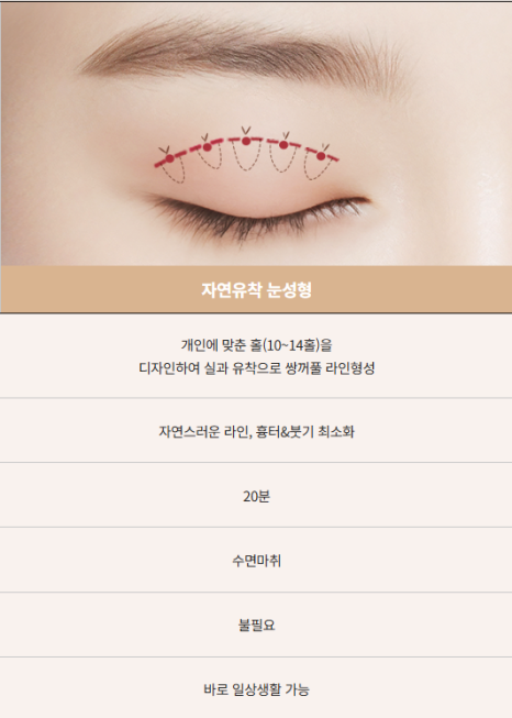 여름철 휴가 전 쌍꺼풀 수술 붓기 관리와 회복 TIP 관련 이미지 4