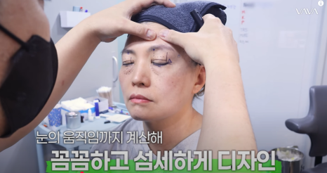 50대에도 자신감 가득 엄마의 두번째 리즈시절, 중년 눈성형&middot;하안검&middot;이마거상 리얼 후기 관련 이미지 6