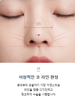첫 재수술 실패로 잃어버린 코 라인 되찾기 관련 이미지 10