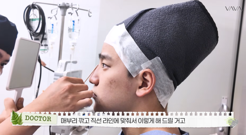 무보형물 직선라인 코성형으로 주먹코&middot;복코 개선｜압구정 바바성형외과 사례 관련 이미지 11