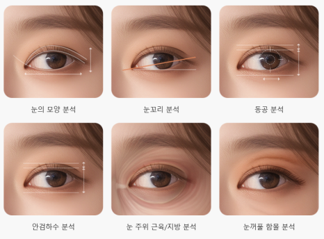 쌍꺼풀 재수술, 흉터 없이 가능할까? 관련 이미지 12