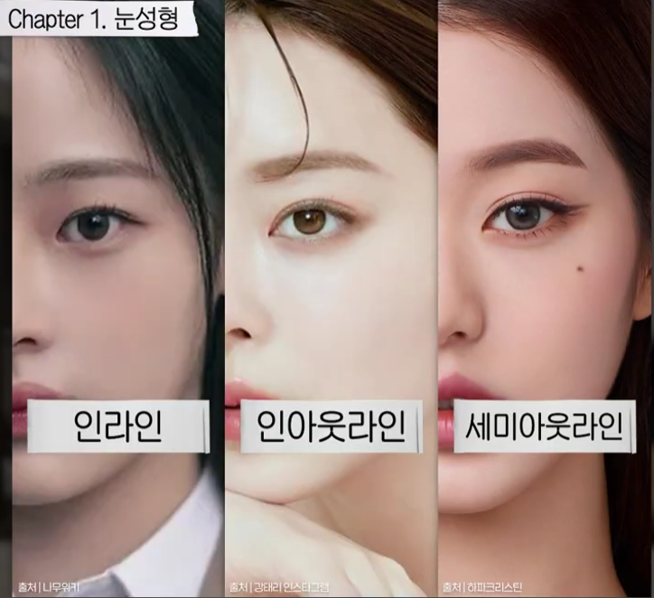 여름철 휴가 전 쌍꺼풀 수술 붓기 관리와 회복 TIP 관련 이미지 5