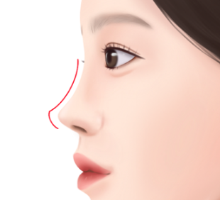 직반라인 코 vs 자려한 코 차이 총정리｜요즘 코성형 트렌드 어떤 라인이 더 인기일까? 관련 이미지 3