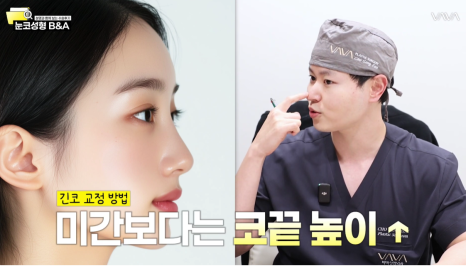 복코 매부리코 긴코 교정 ㅣ 코성형 전후 케이스 (NJZ민지 코) 관련 이미지 8