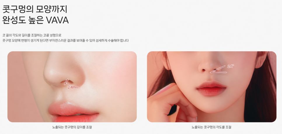 The Secret to a Refined Nose Line Lies in the Tip | BABA Plastic Surgery Tip Plasty image 2