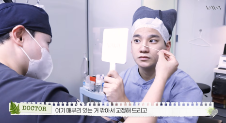 무보형물 직선라인 코성형으로 주먹코&middot;복코 개선｜압구정 바바성형외과 사례 관련 이미지 7