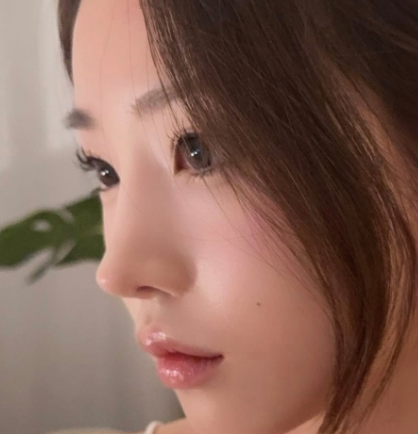 내 얼굴형에 맞는 코, 따로 있습니다 &mdash; 코성형 전 체크해야 하는 5가지 비율 관련 이미지 3