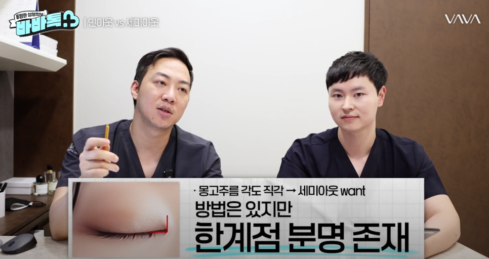 세미아웃라인 인아웃라인 쌍꺼풀 잘 받는 타입 (몽고주름) 관련 이미지 13