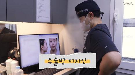 코재수술로 인상까지 달라질 수 있을까?｜바바성형외과 직반라인 코재수술 후기 관련 이미지 4
