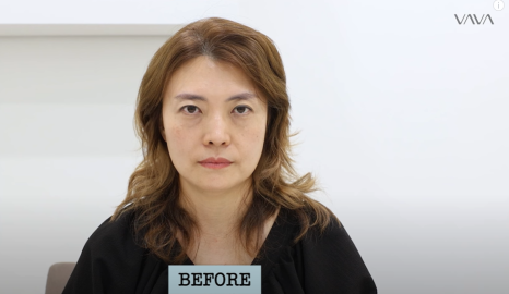 50대에도 자신감 가득 엄마의 두번째 리즈시절, 중년 눈성형&middot;하안검&middot;이마거상 리얼 후기 관련 이미지 1