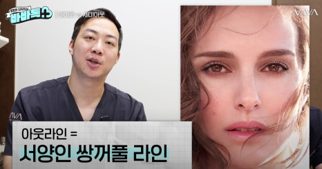 세미아웃라인 인아웃라인 쌍꺼풀 잘 받는 타입 (몽고주름) 관련 이미지 3